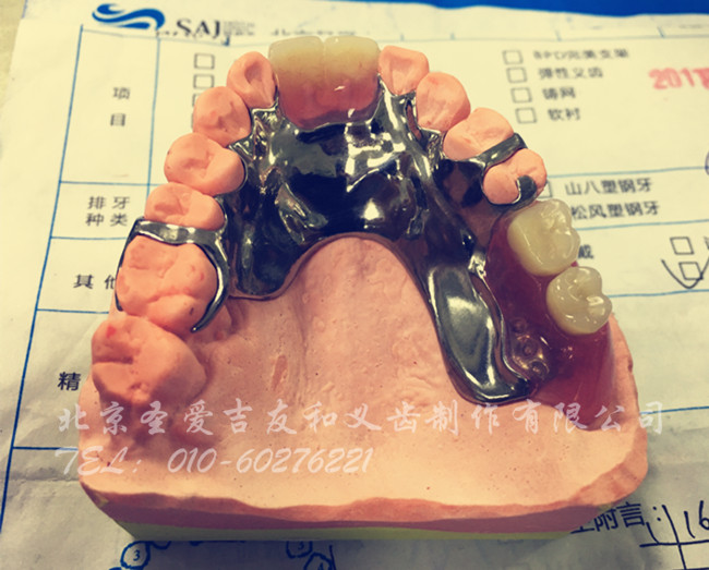 纯钛支架 ,请各位老师点评指导